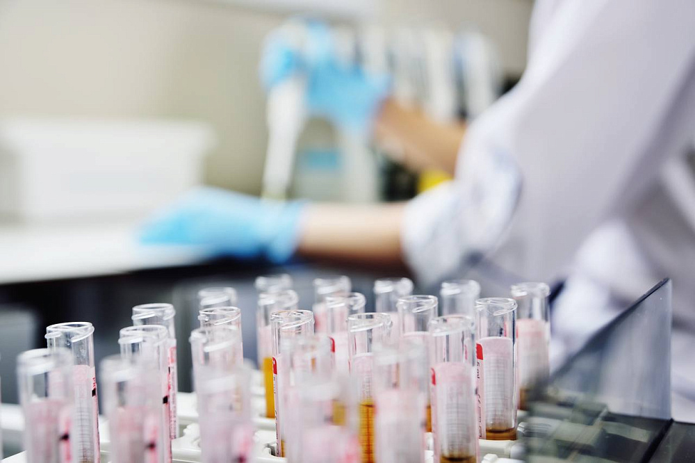 Полногеномный поиск ассоциаций по вариациям числа копий генов позволил выявить новые связи с фенотипическими признаками